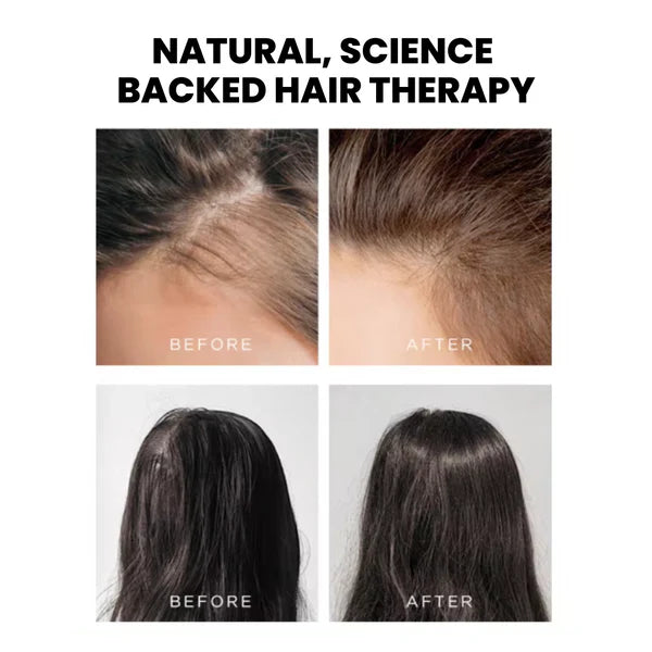 LuxeLight Therapy Brush